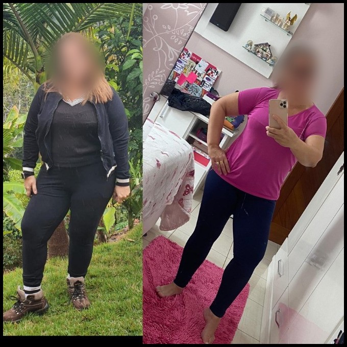 Antes e depois de aluna do Seca em 30