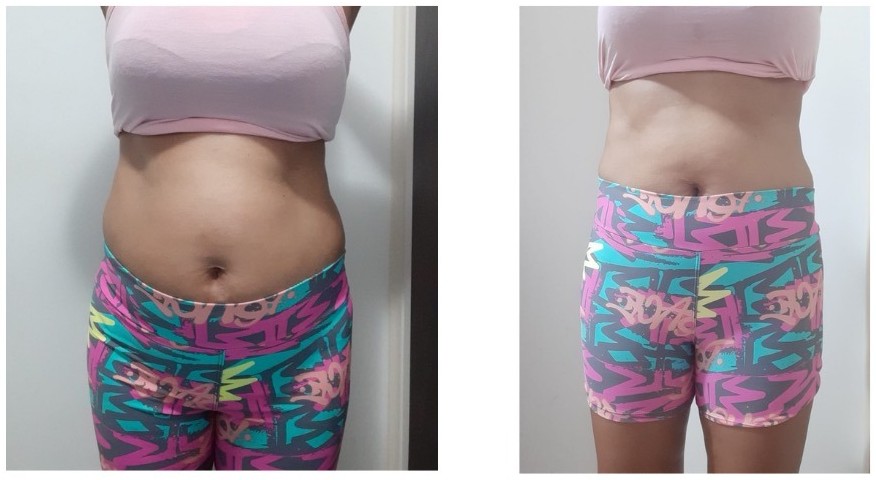 Antes e depois de aluna do Seca em 30